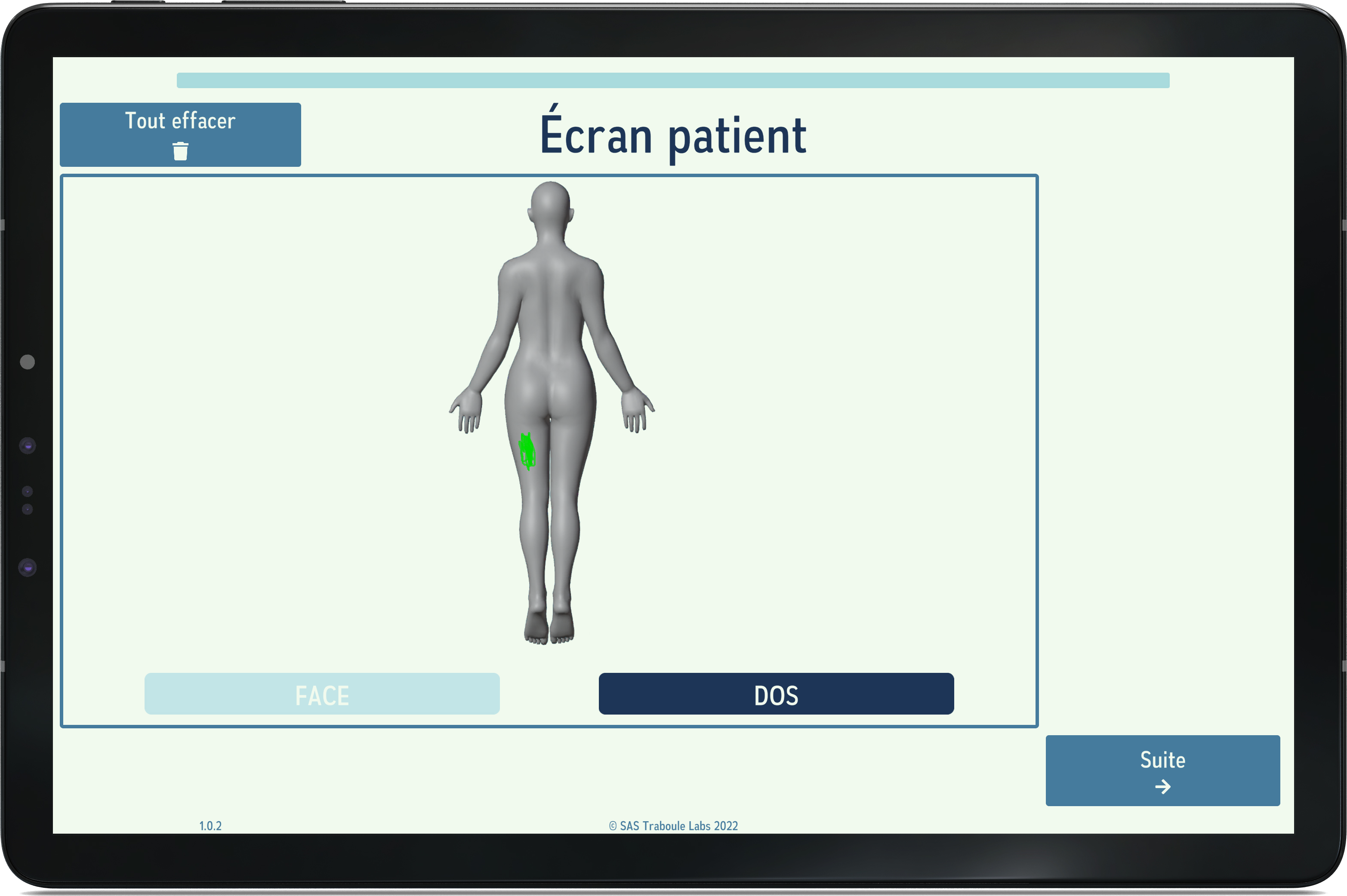 Visuel d'un écran de l'application EASY PAIN